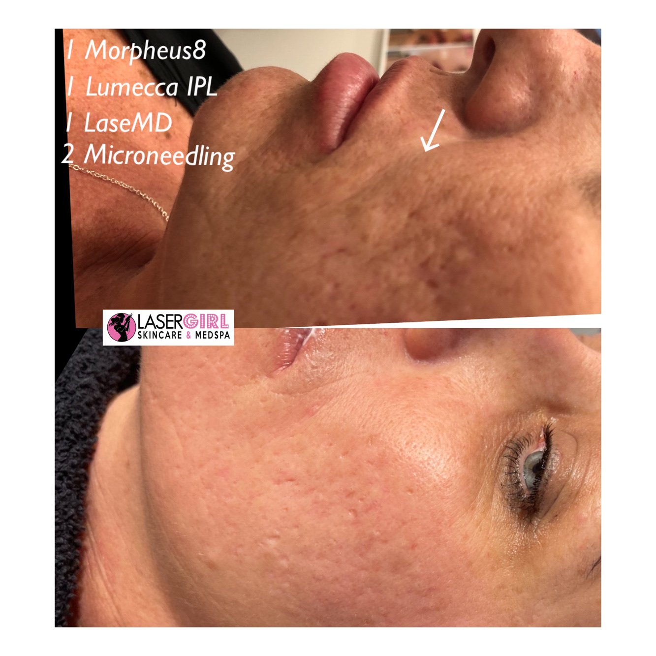 Laser Girl Skincare Med Spa In Bellaire TX Vagaro