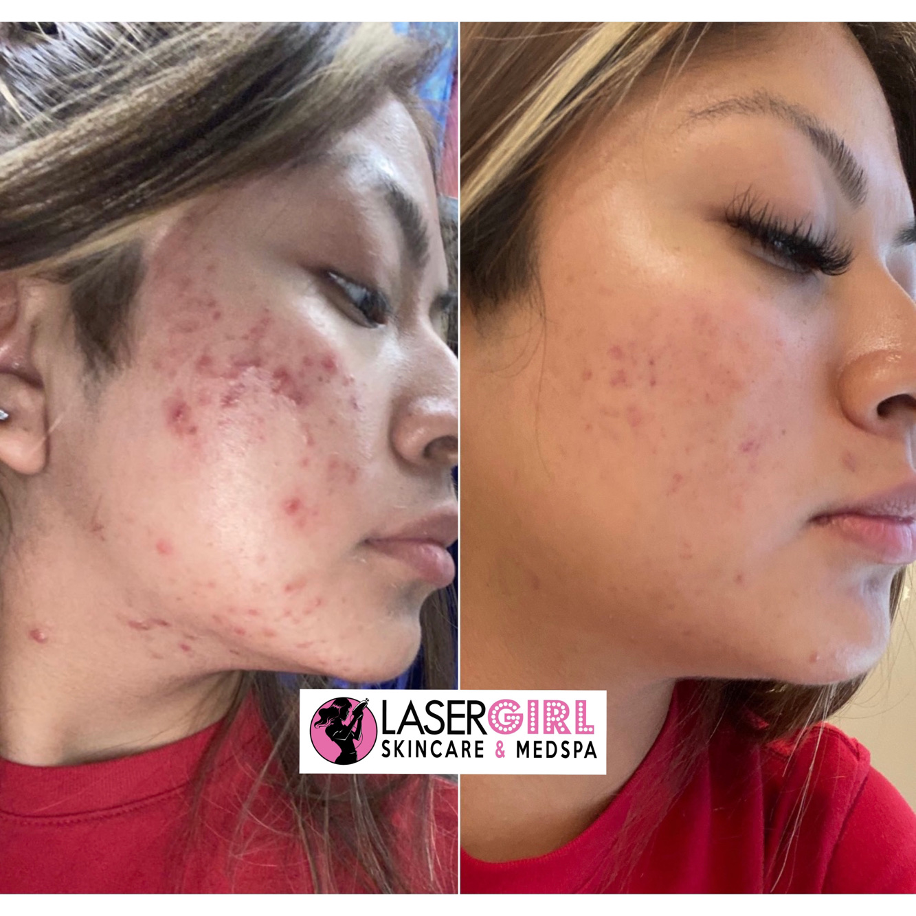 Laser Girl Skincare Med Spa In Bellaire TX Vagaro